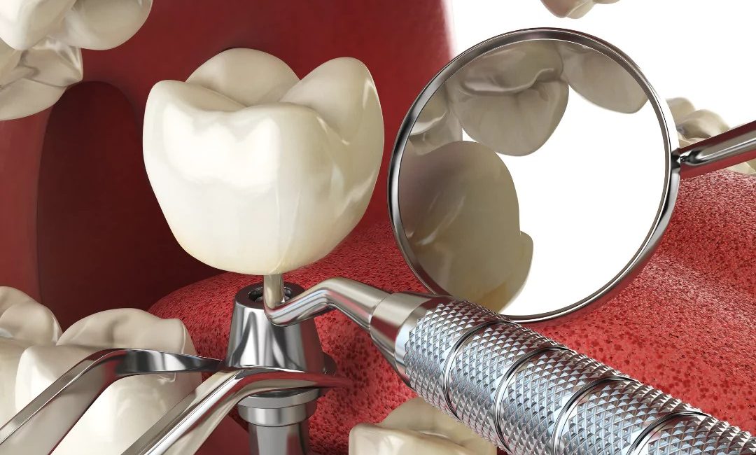 Ephesus Health Group Dental Specialized Implant Care